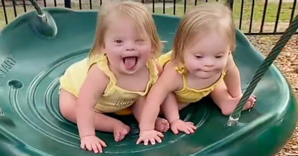 cute identical twins with downs
