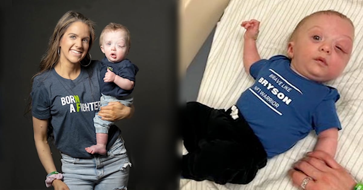 Lindsey Marson and son both have neurofibromatosis