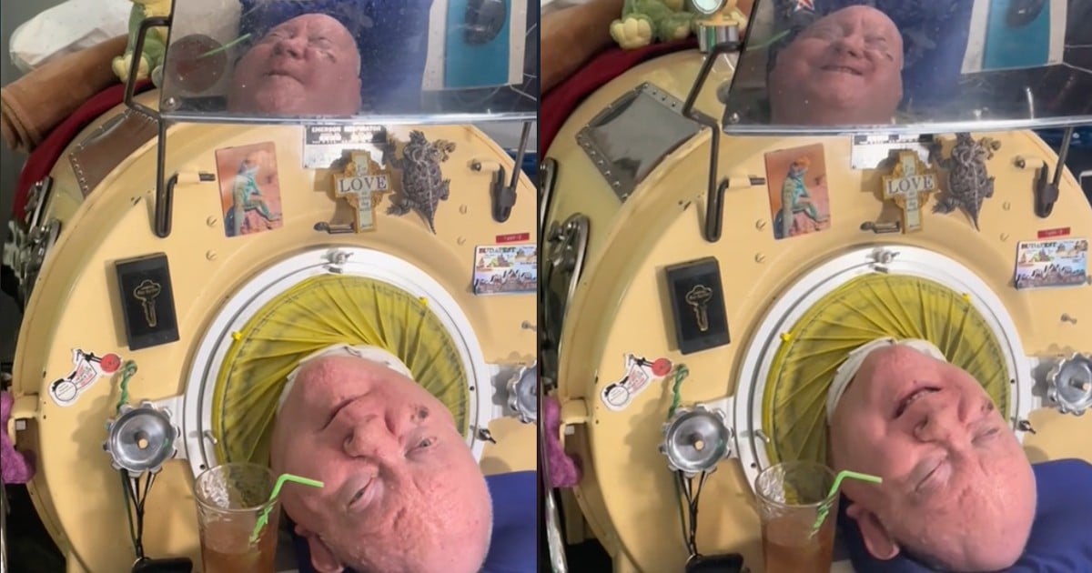 man who lived in iron lung